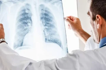 مركز السلام للاشعة