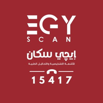 ايجى سكان للاشعة والتحاليل الطبية